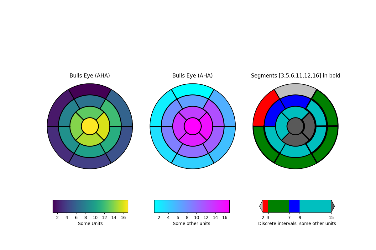 ../../_images/leftventricle_bulleye.png