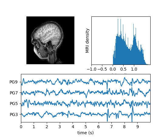 ../../_images/mri_with_eeg.png