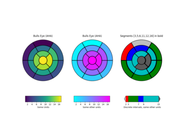 leftventricle_bulleye